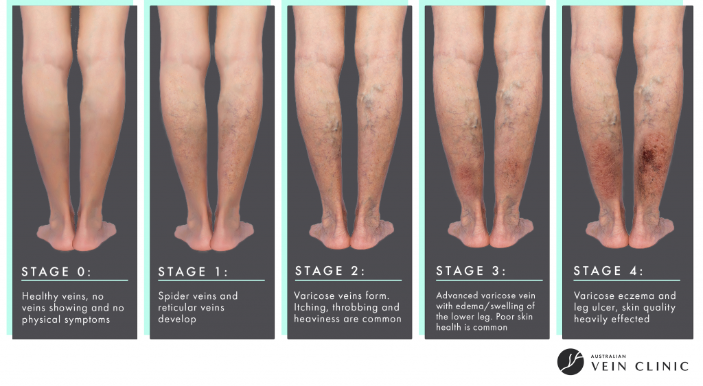 Before and after treatment comparison